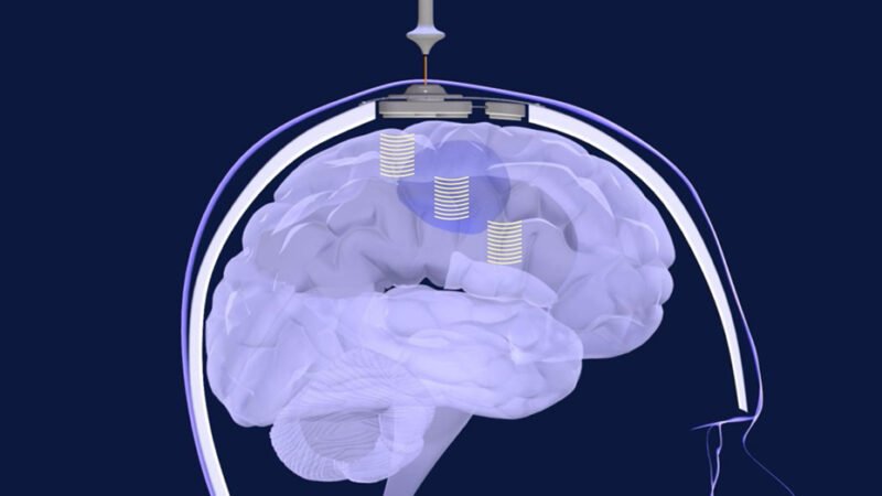 Andalucía se une a ensayo pionero contra glioblastoma