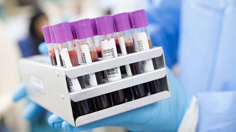 Investigación sobre la salud cardiovascular en mujeres durante la menopausia.